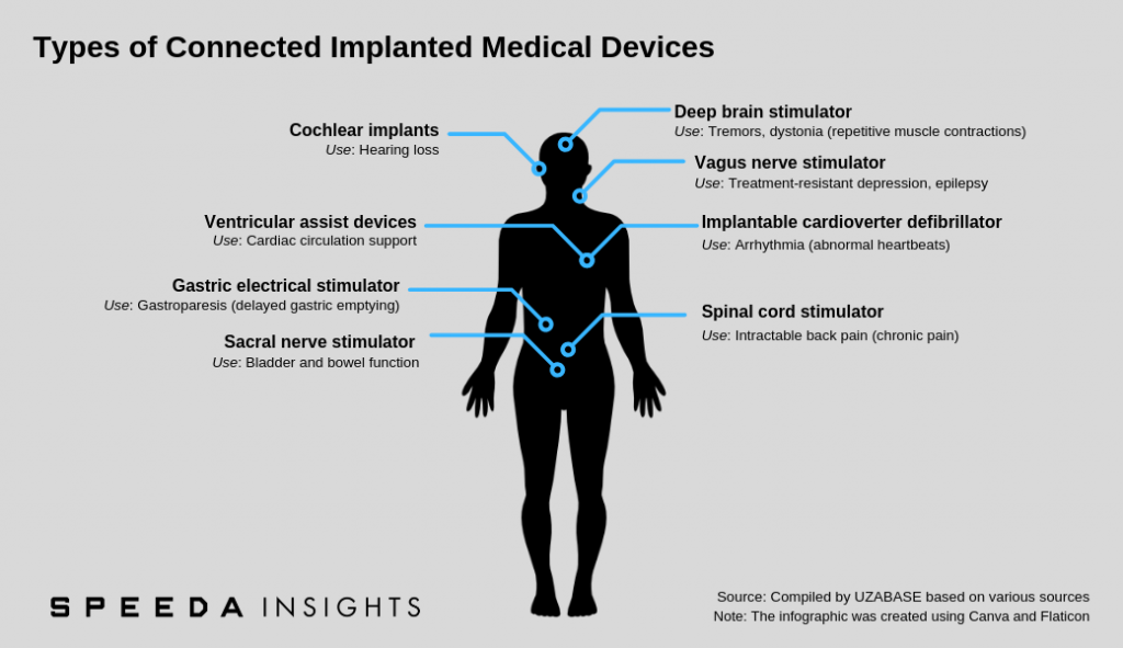 SPEEDA Body Talks The Future of the Connected Implanted Medical